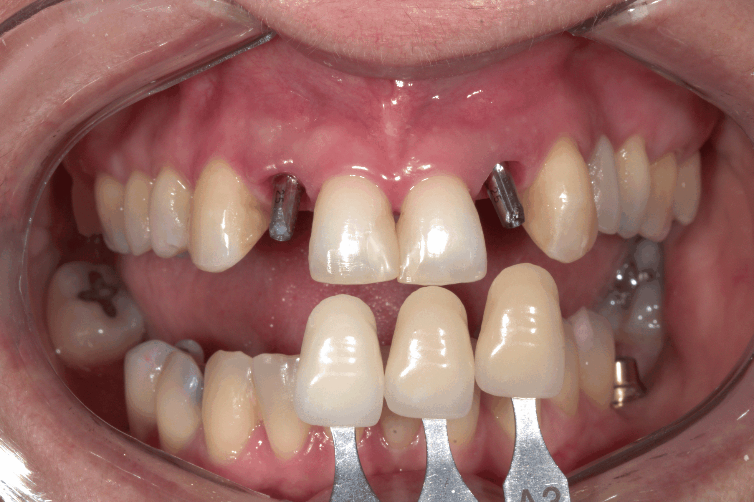 IMG_4332 (3) IMG_4332 (3)