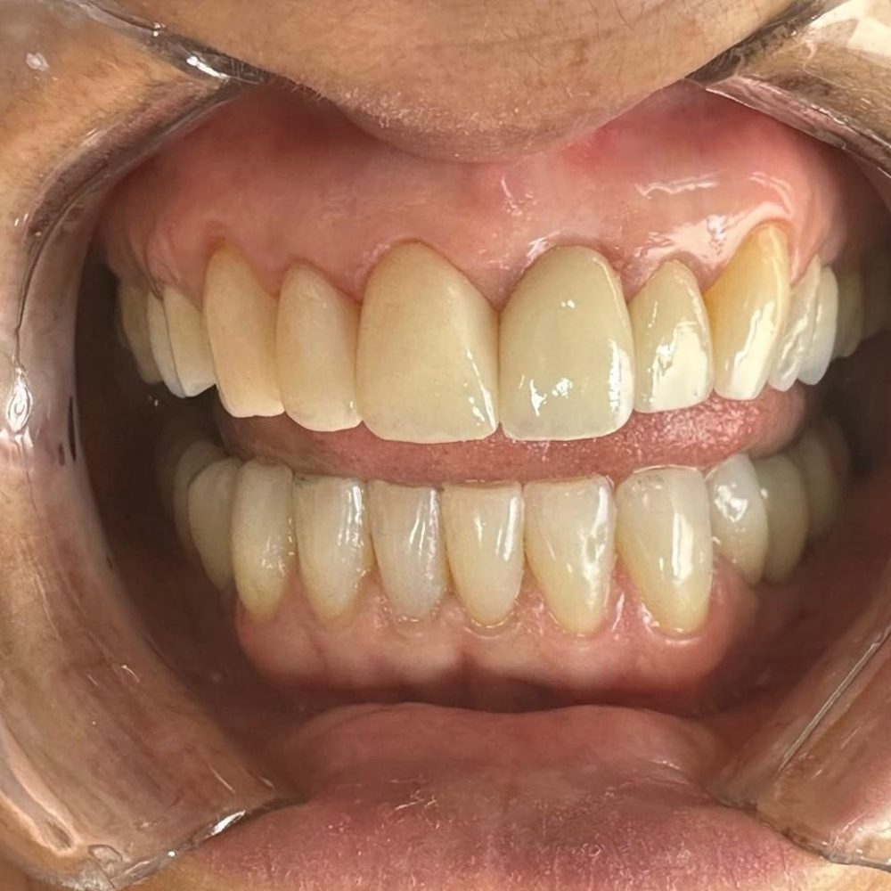 WhatsApp Image 2025-11-12 at 14.00.59